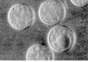 Figure 12. Entomophaga fungus resting spores. Twenty-five laid end to end would measure 1 mm.